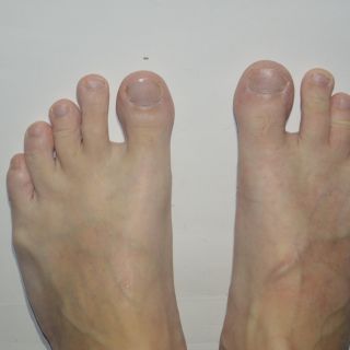 Reduziert übermäßiges Schwitzen